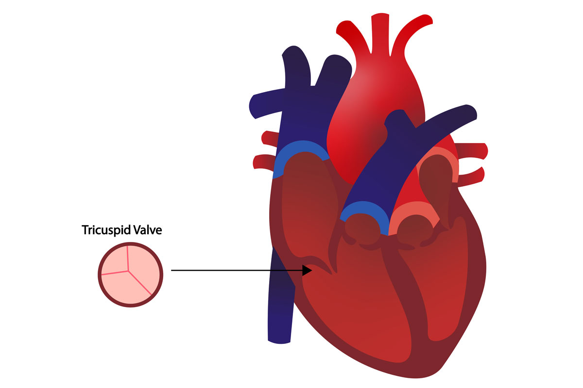 מסתם טריקוספידלי